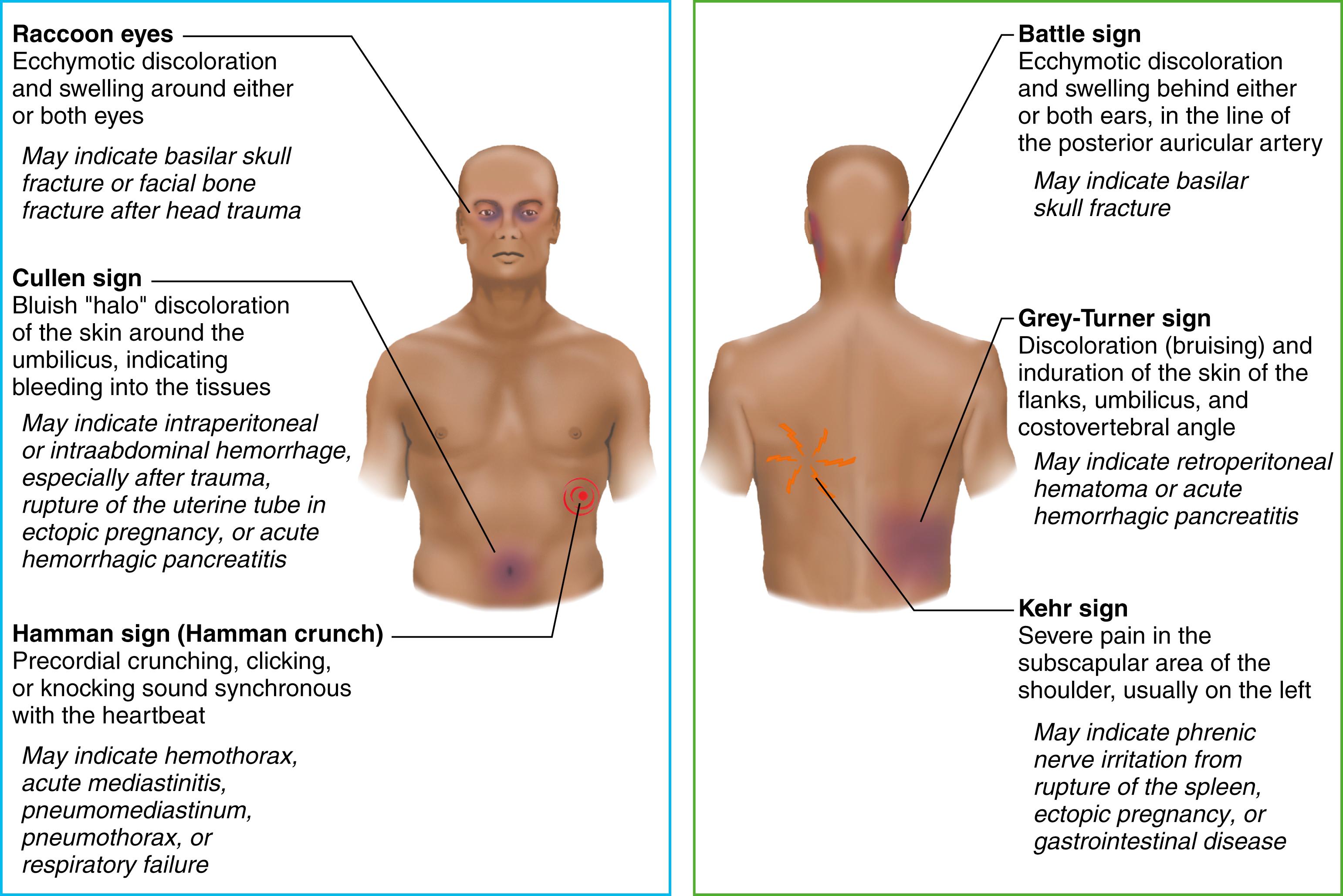 FIG. 26.5, Signs that indicate serious injury associated with trauma.