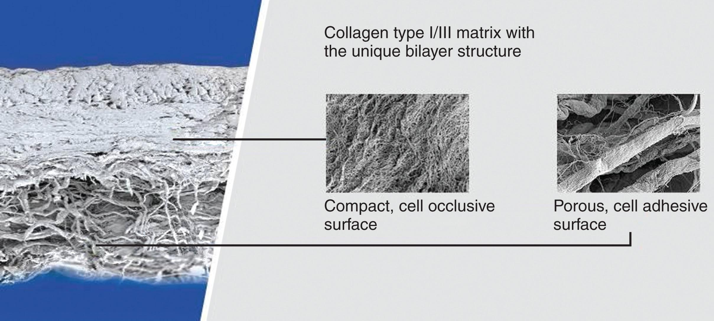 Fig. 16.6, Bilayer structure of Chondro-Gide porcine type I–III membrane.