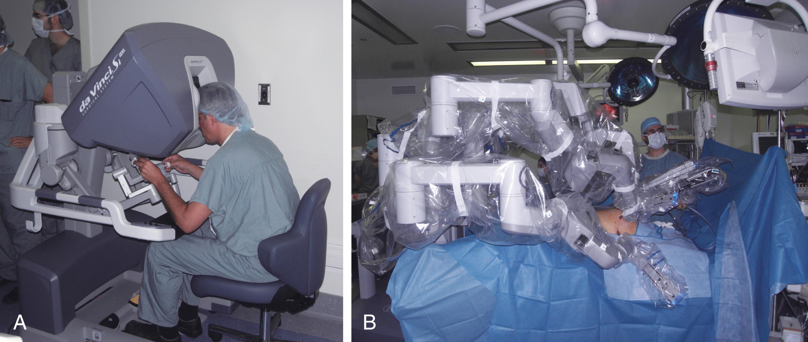 Fig. 15.7, Robotic surgery. (A) The surgeon at the console uses his hands and feet to control the robot arms. (B) Robotic setup at the patient.