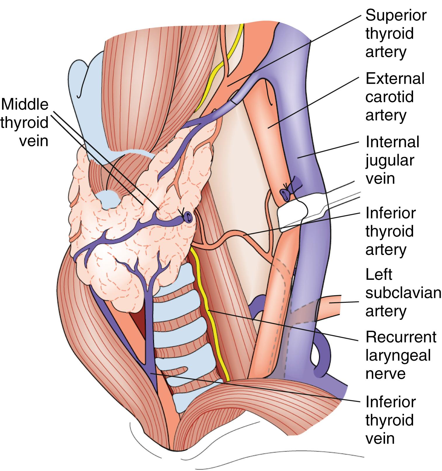 Fig. 21.1, Anatomy of the thyroid gland. The middle thyroid vein has been divided to allow forward rotation of the left lobe of the gland.