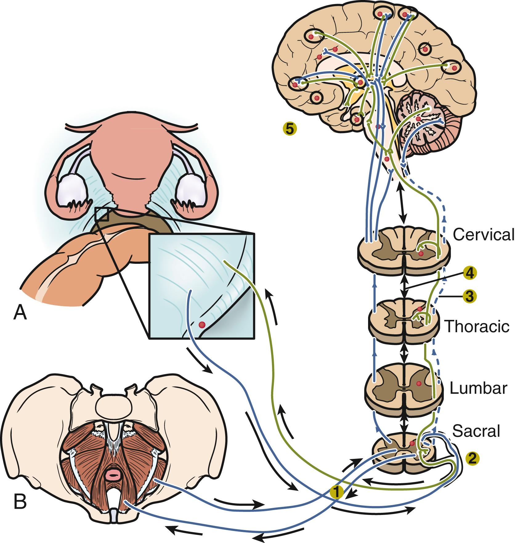 Fig. 27.2, Central sensitization.