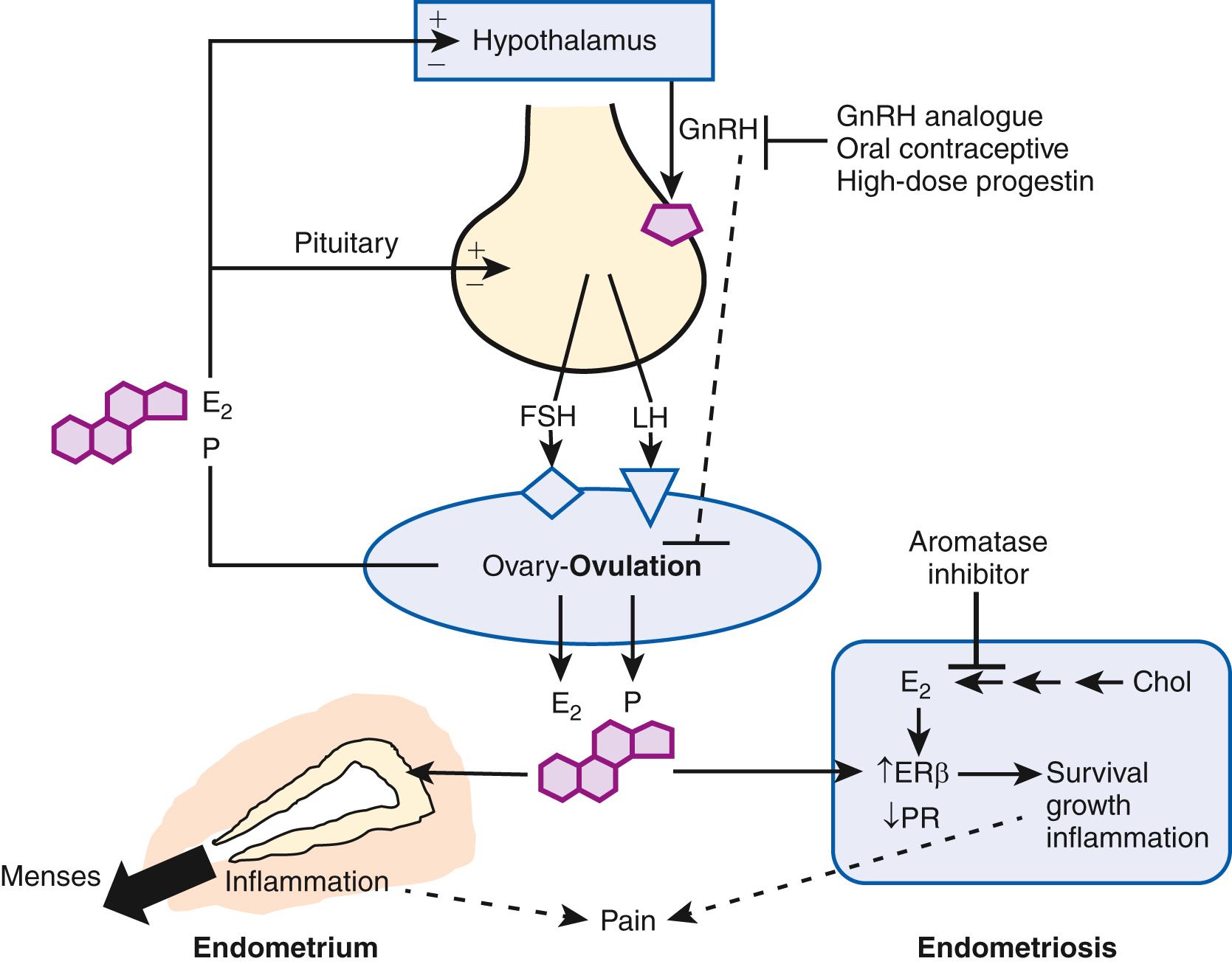 Fig. 27.4, Mechanisms of ovulation, menstruation and pain, and targets of treatment in endometriosis.