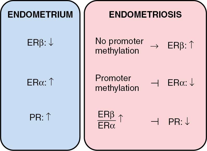 Fig. 19.5, Steroid receptor expression in endometriosis. ER, Estrogen receptor; PR, progesterone receptor.
