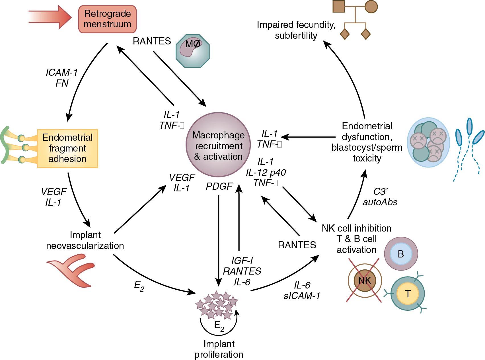 Fig. 19.7, Schematogram depicting the network of chemokines, cytokines, and growth factors in the pathophysiology of endometriosis. autoAbs, Autoantibodies; C3, complement 3; E 2 , estradiol; FN, fibronectin; sICAM, soluble intercellular adhesion molecule; IGF-1, insulin-like growth factor-1; IL, interleukin; MØ, macrophage; NK cell, natural killer cell; PDGF, platelet-derived growth factor; RANTES, regulated on activation, normal T cell expressed and secreted; TNF, tumor necrosis factor; VEGF, vascular endothelial growth factor.