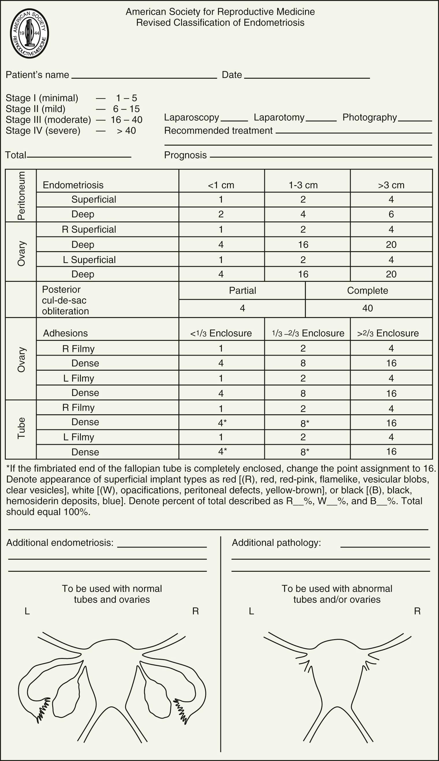 FIGURE 25-3, Modification of the revised American Society for Reproductive Medicine classification of endometriosis.