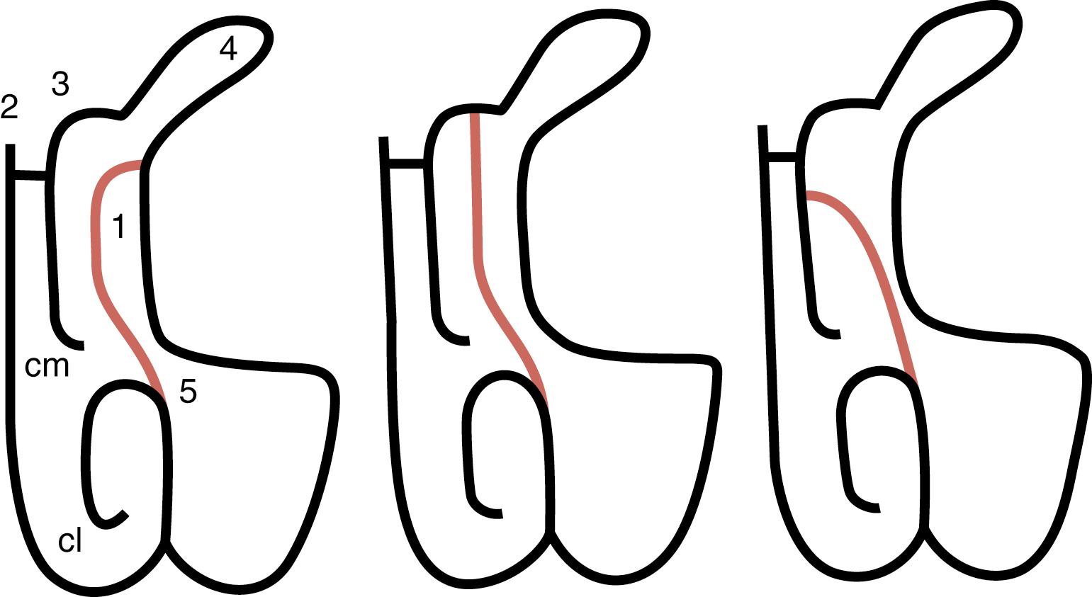 Fig. 112.1, Line diagram of the uncinate attachment.