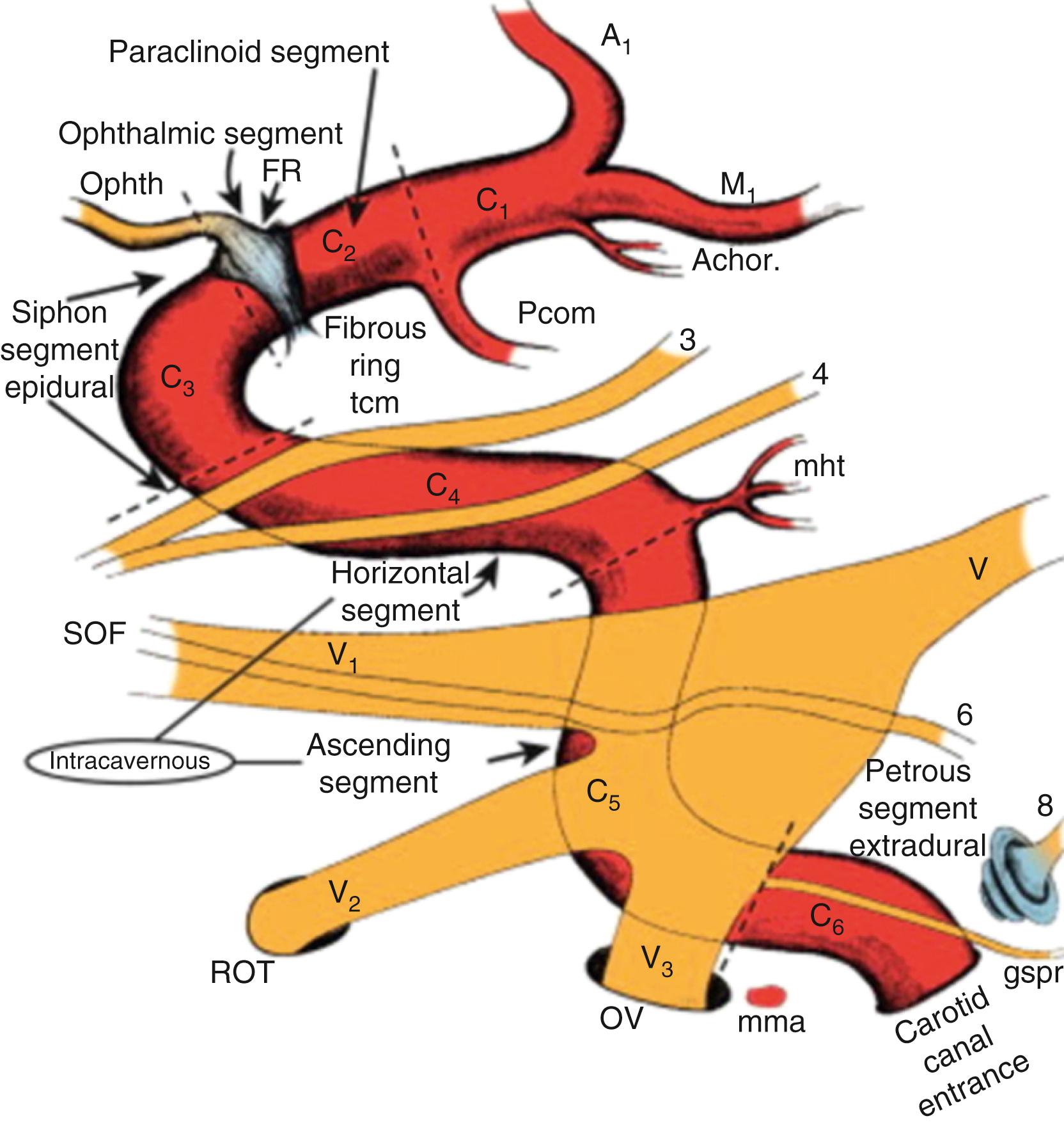 FIGURE 12.6, Cavernous anatomy: Drawing of the neurovascular structures traversing within the cavernous sinus.