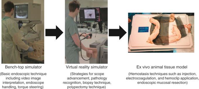 FIG 13.1, An example progressive endoscopic simulation-based curriculum where learners proceed to training at progressively increasing levels of difficulty over time and simulator models are matched to the task.