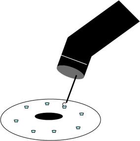 Figure 13.2, Marking the periphery of a lesion prior to endoscopic mucosal resection.