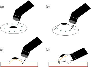 Figure 13.6, Technique of endoscopic submucosal dissection (ESD). (a) Marking of the planned resection margin, (b) submucosal injection, (c) incision into the submucosa with an ESD knife, and (d) elevation of the lesion off the muscularis mucosa with dissection into the submucosal plane using an endoscopic cap.