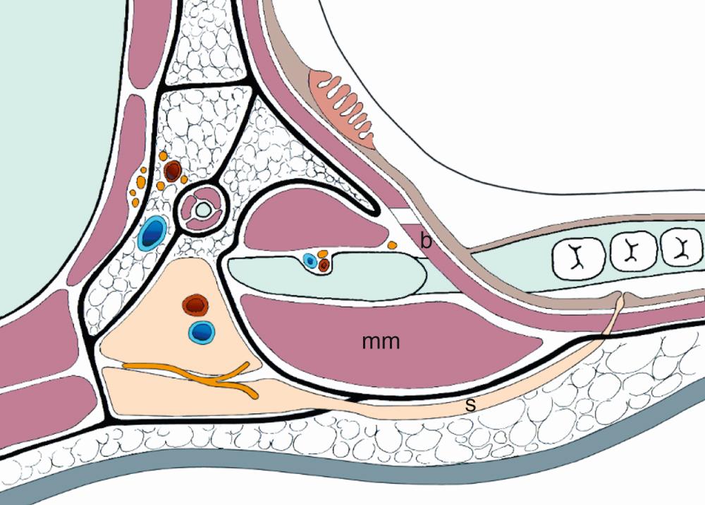 Fig. 19.1, The schematic axial section anatomy of Stensen's duct. b, buccinator muscle; mm, masseter muscle; S, Stensen's duct.