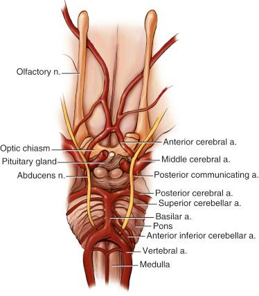 Fig. 29.4, Drawing of the neurovascular structures superior to the pituitary sella. A1, A2 segments of the carotid artery, and the anterior communicating artery lie superior to the optic chiasm and often come into visualization in the removal of anterior skull base meningiomas and craniopharyngiomas. a., Artery; n., nerve.