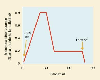 Fig. 30.2, Time course of appearance and resolution of contact lens–induced endothelial blebs.