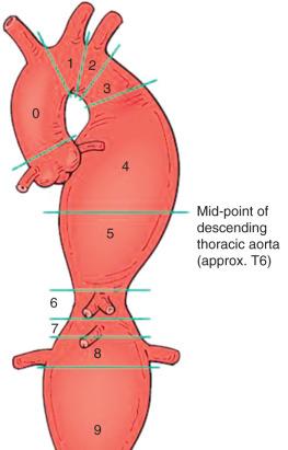 FIG 37.1, Classification of landing zones.