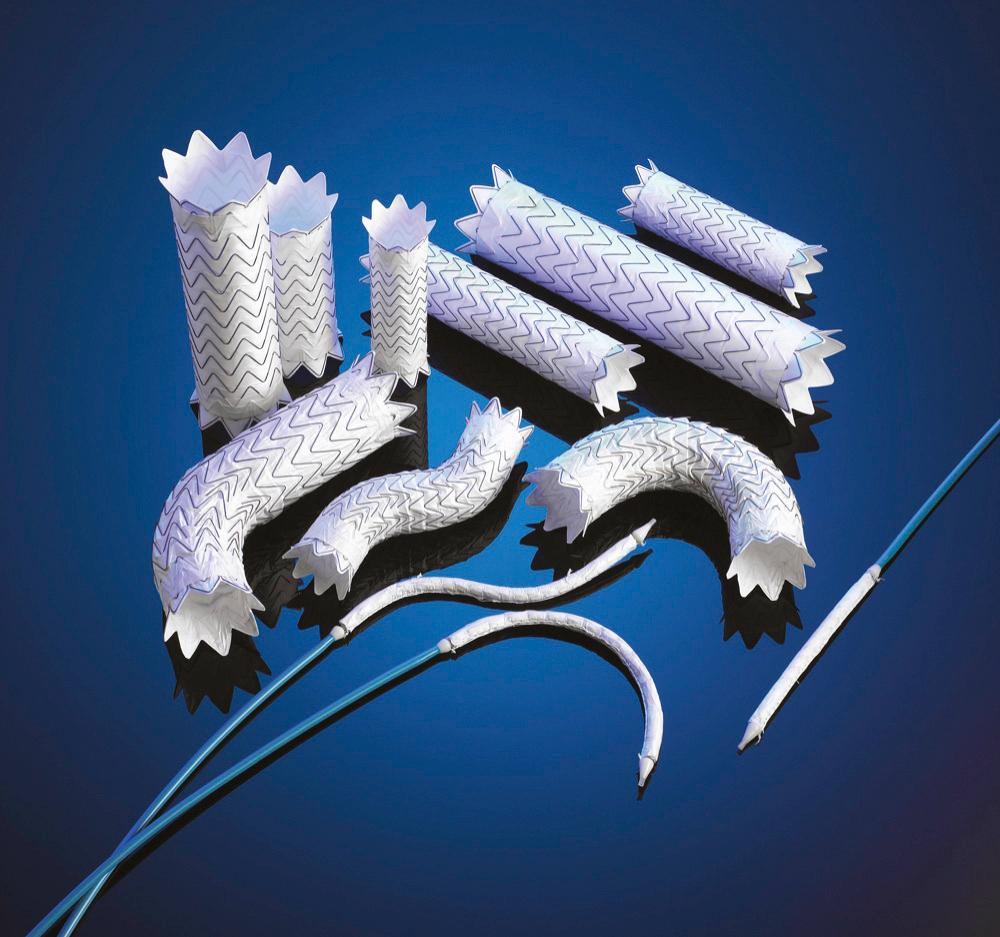 FIGURE 72-2, The Gore TAG thoracic endoprosthesis.