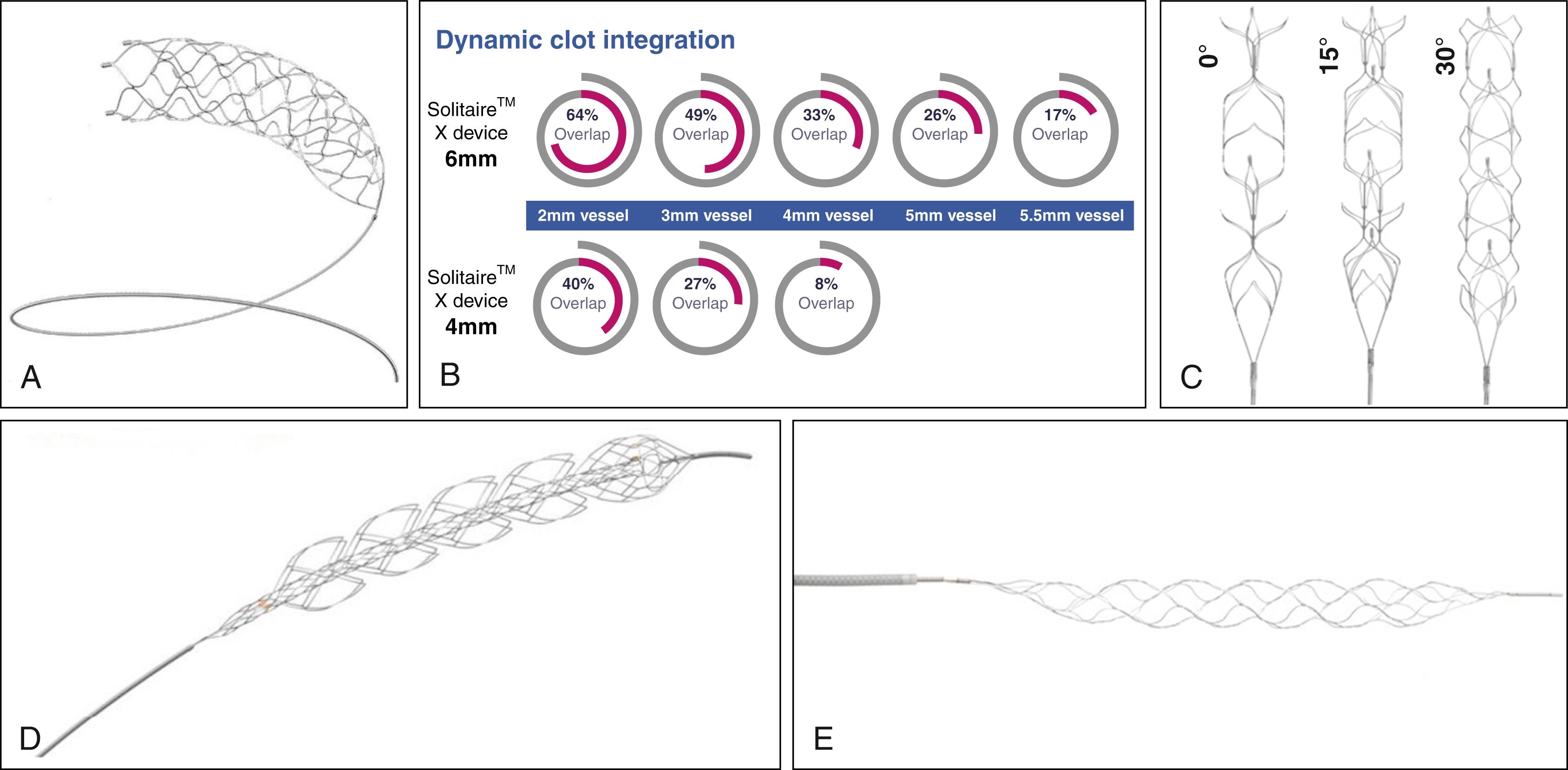 Fig. 67.1, (A) Solitaire device (Medtronic Neurovascular, Irvine, CA). (B) The unique design of the Solitaire with an open cell design allows for overlapping of the stent when deployed in vessels below the nominal diameter of the device, providing multiple planes of clot integration into the device. (C) Penumbra three-dimensional separator (Penumbra, Alameda, CA). (D) EmboTrap II Revascularization Device (Cerenovus, J&J Medical Devices, New Brunswick, NJ). (E) Trevo ProVue (Stryker Neurovascular, Kalamazoo, MI).