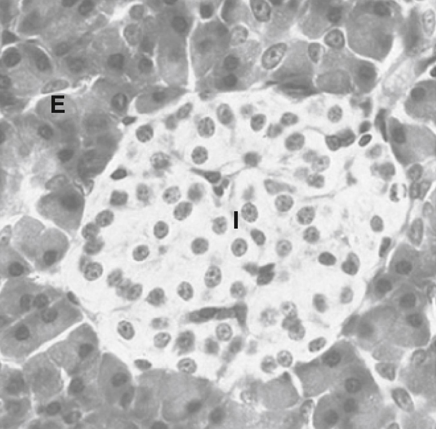 Fig. 3.2, The endocrine Islet of Langerhans ( I ) surrounded by exocrine pancreatic tissue ( E ).