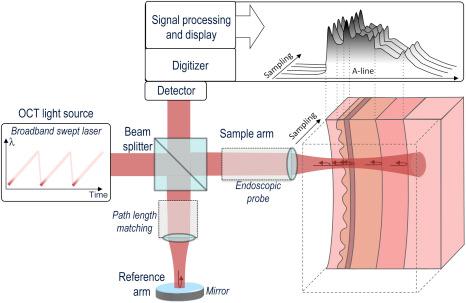 Figure 8.1, Schematic representation of endoscopic OCT system with a catheter placed in the sample arm. This particular OCT configuration is an SS-OCT or OFDI system, which is currently the most commonly used method for esophageal OCT imaging.