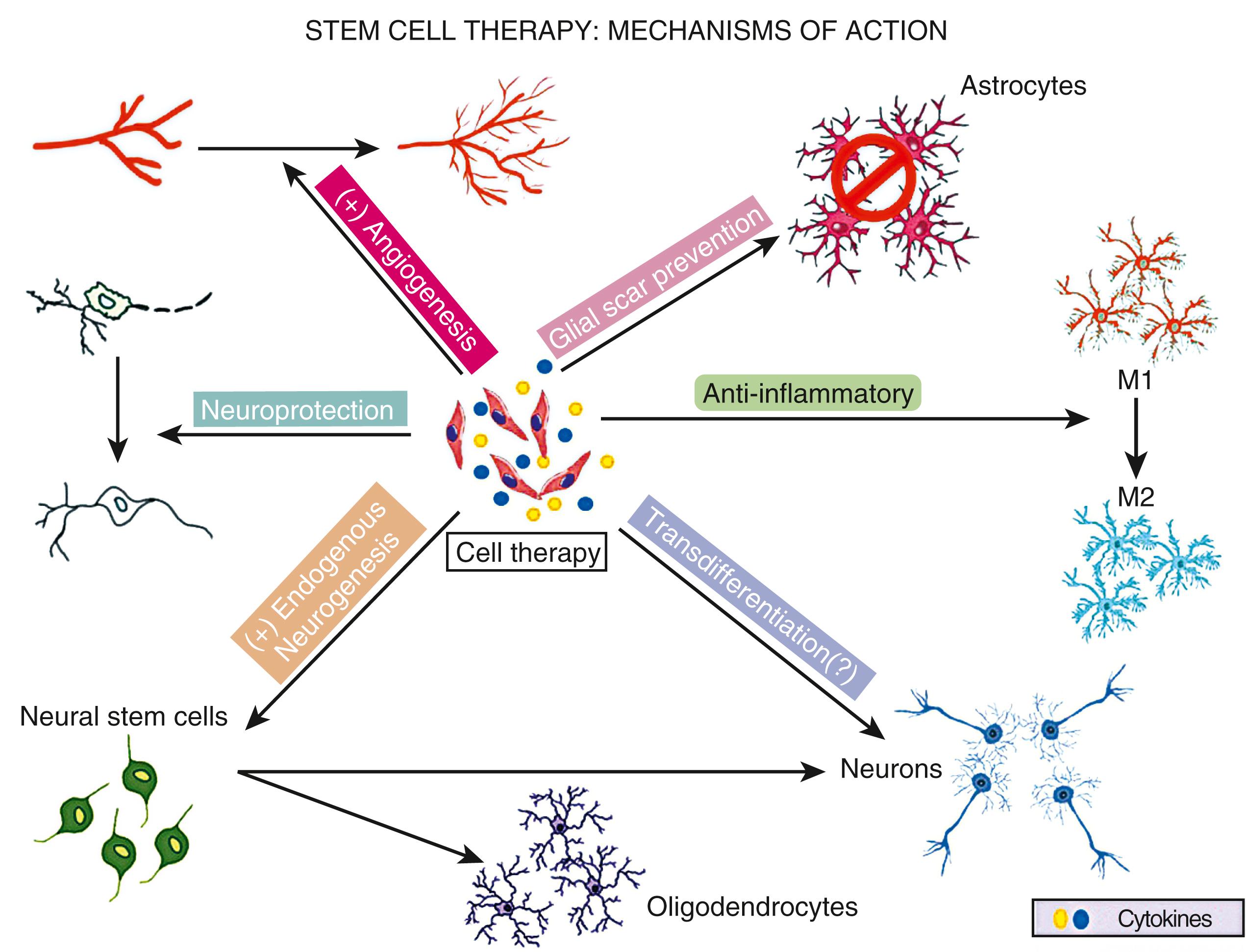 Fig. 62.1, Cell therapy—mechanisms of action in stroke. Several mechanisms by which various types of cell therapies may improve recovery after stroke. Different types of cell therapies release biologic factors that directly influence local endogenous repair responses, promote neuroprotection, and modulate the inflammatory/immune response. Some types of cell therapies may activate endogenous cells to release biologic factors that promote repair and protection.