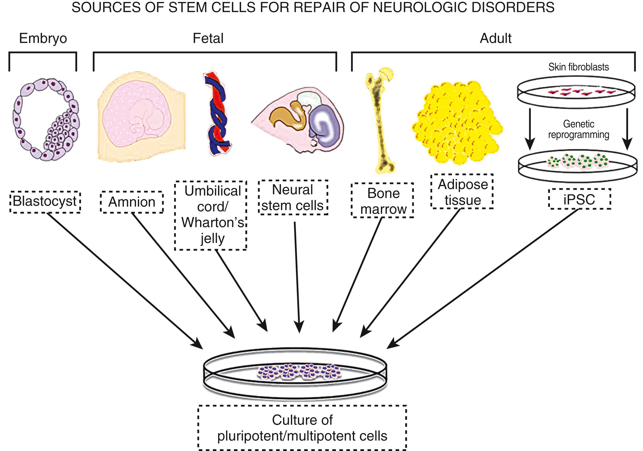 Fig. 62.4, Stem cells—sources. Cell therapies have been isolated and cultured from a variety of sources for their use as a therapeutic modality in experimental studies of ischemic stroke and other neurologic disorders.