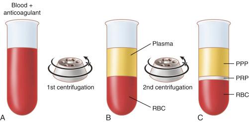 FIG. 24.1, (A) a tube containing whole blood and an anticoagulant such as heparin or ACD-A prior to centrifugation. After centrifugation (B), whole blood is separated into 2 phases; primarily red blood cells (RBC) are found in the bottom phase and plasma has been separated into the top phase. If a second centrifugation is performed (C), dependent upon the system used, three phases are obtained with RBCs in the bottom phase, a buffy coat containing platelet rich plasma (PRP) in the middle phase, and the platelet poor plasma (PPP) in the top phase.