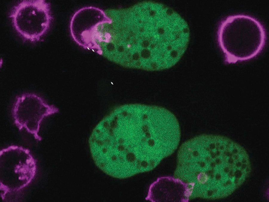 FIG. 272.3, Trogocytosis-like killing of host cells by Entamoeba histolytica .