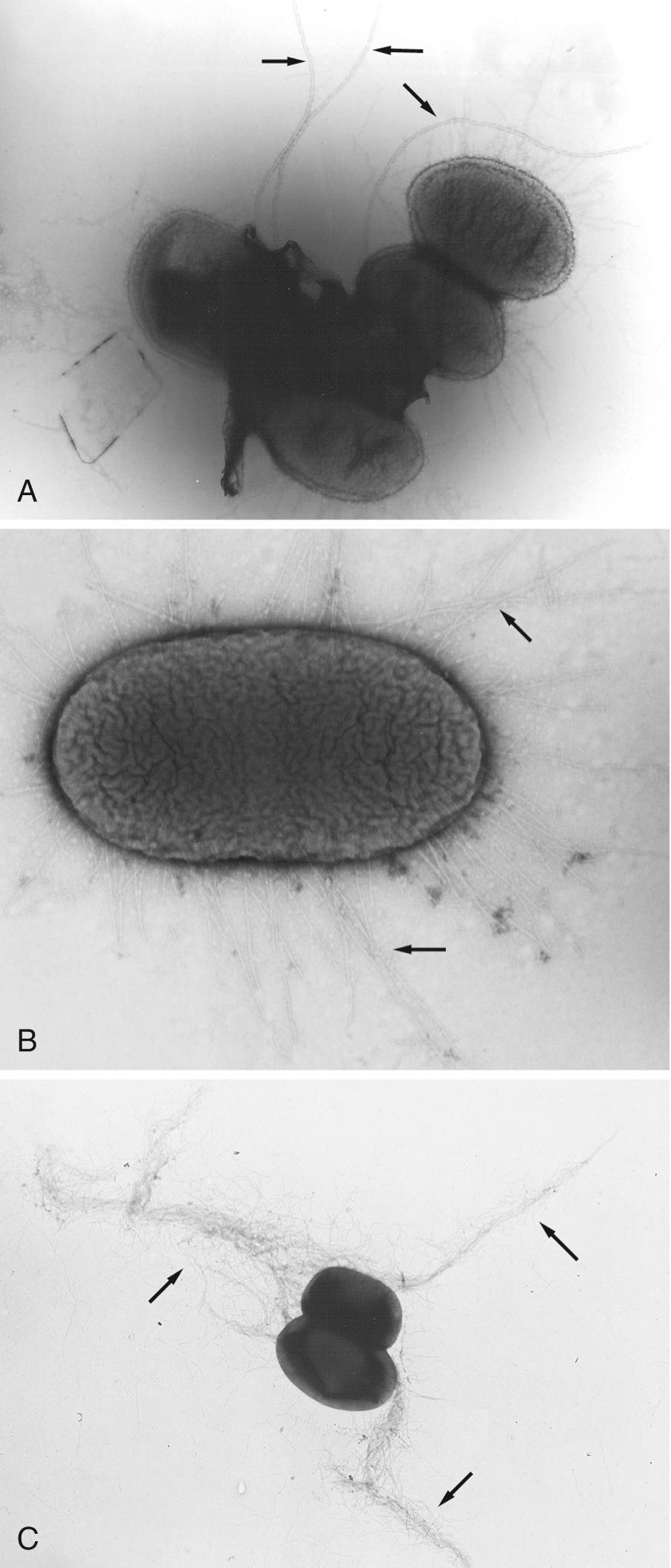 FIG. 218.2, Transmission electron micrographs of Escherichia coli cells.