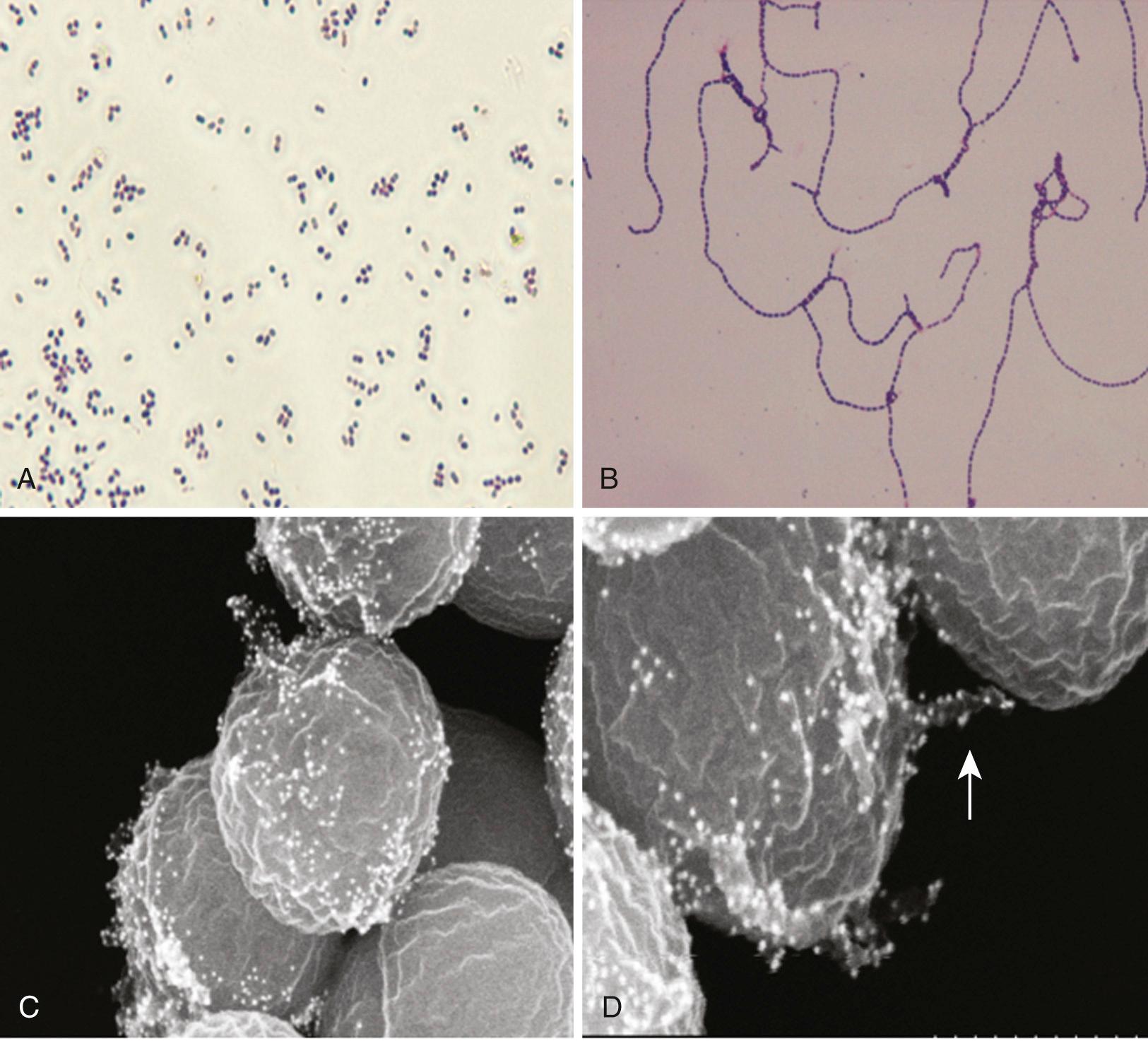 FIG. 200.1, Gram stain and scanning electron microscopy (SEM) of enterococcus faecalis isolates.