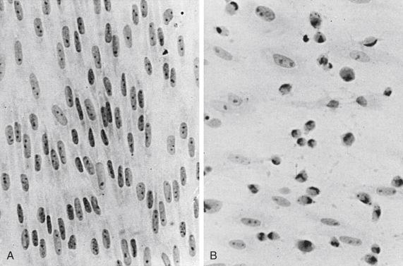 Figure 25-1, Fetal rhesus monkey kidney tissue culture (HL-8). A, Uninoculated tissue culture. B, Echovirus 11 cytopathic effect.