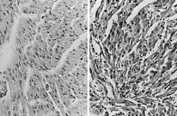 Figure 25-2, Suckling mouse skeletal muscle. A, Normal suckling mouse skeletal muscle. B, Skeletal muscle of suckling mouse infected with coxsackievirus A16.