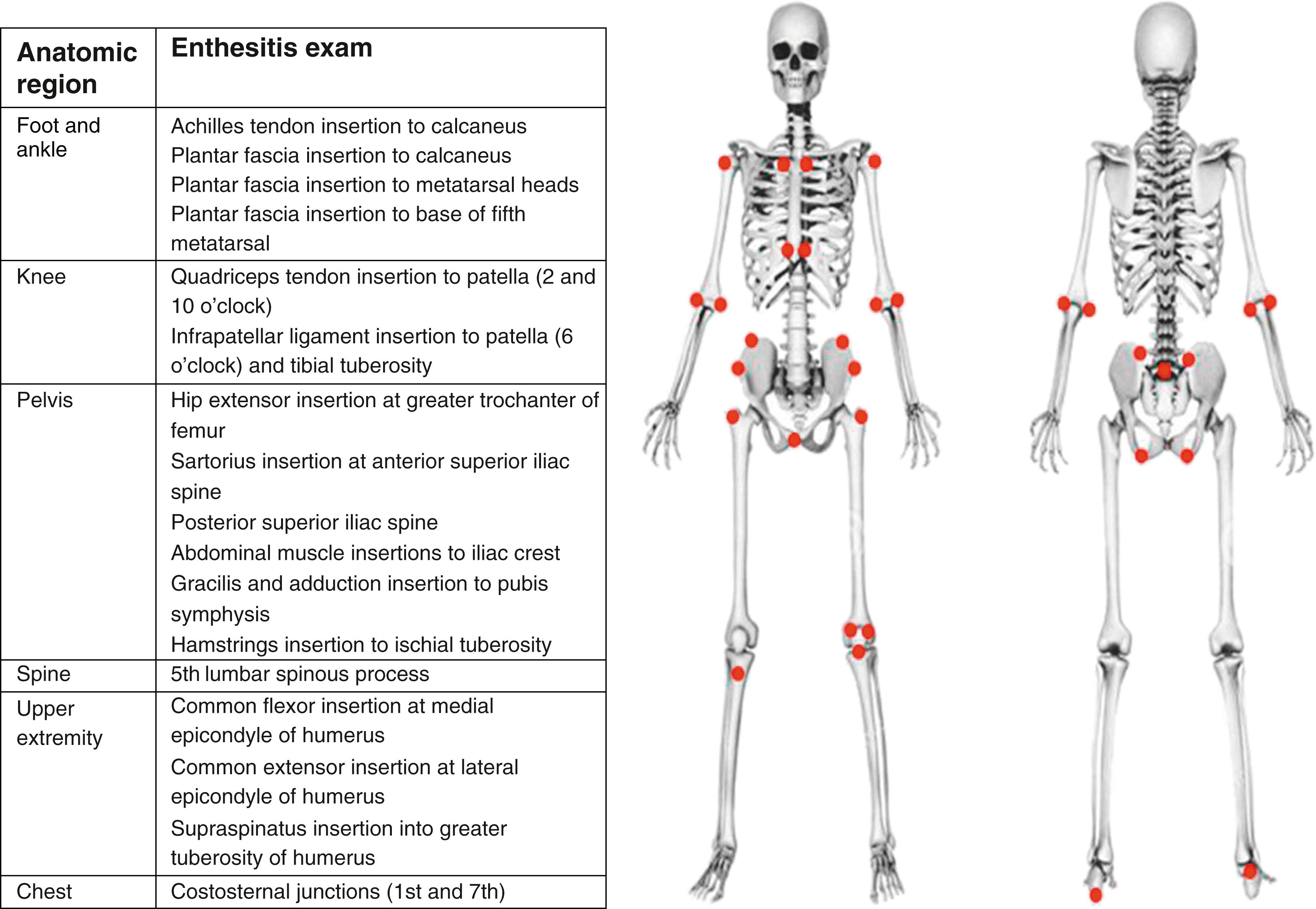 Fig. 20.1, Anatomical sites for assessment of enthesitis in ERA and JAS.