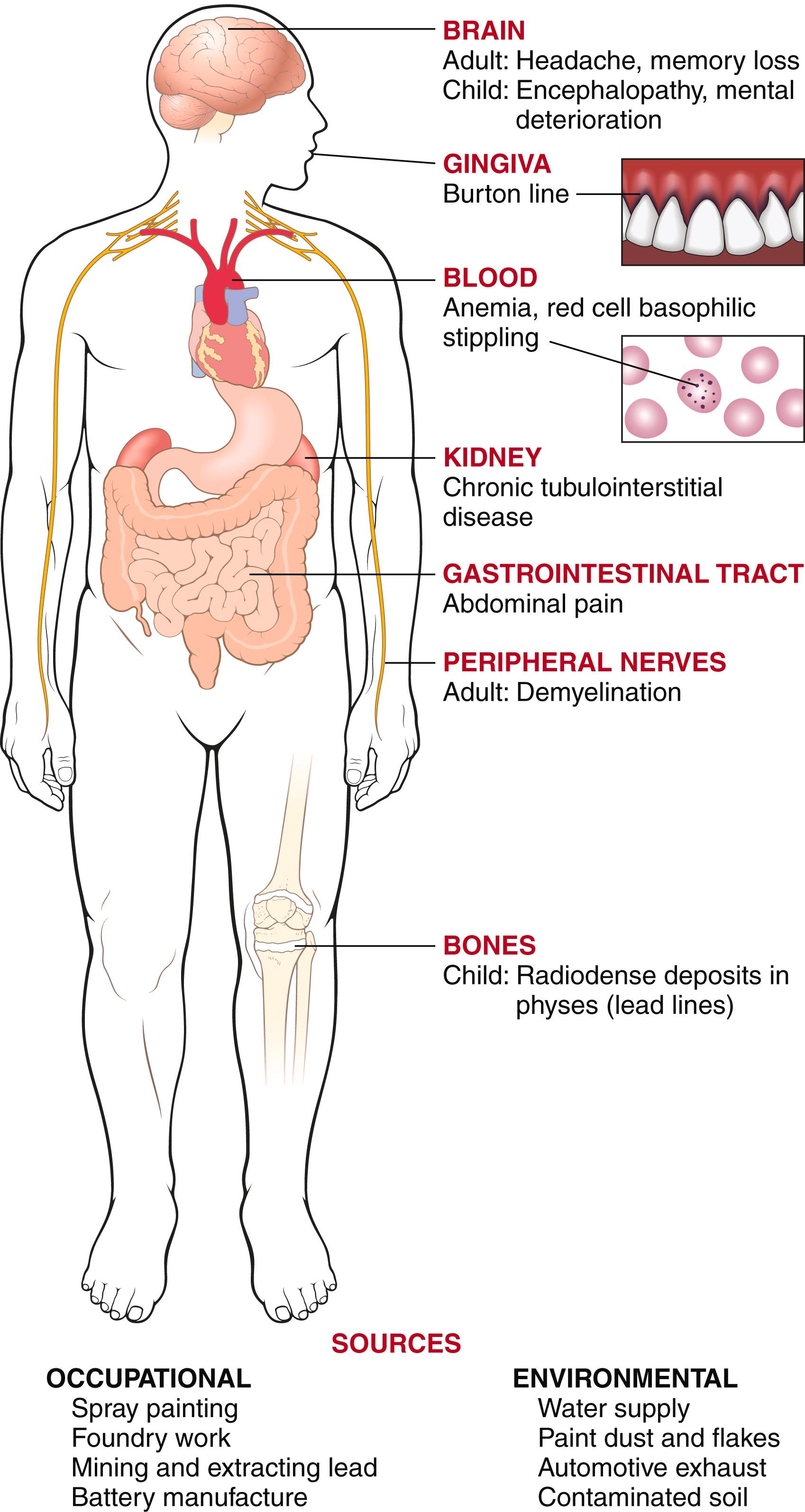 FIG. 7.5, Pathologic features of lead poisoning.