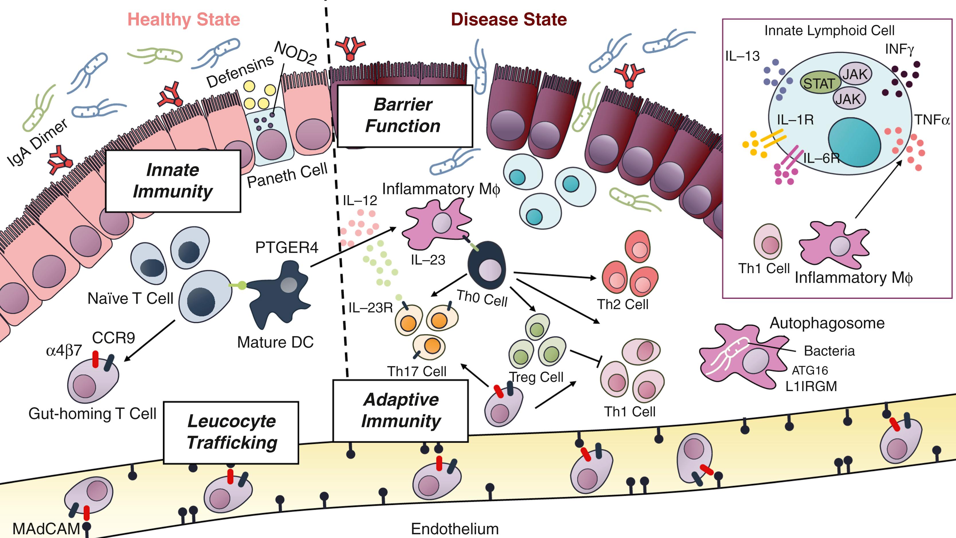 Fig. 115.2, Animal models of IBD, studies of human genetics, and clinical trials with targeted therapeutic agents suggest that IBD is a complex, polygenic disease driven by disturbances in distinct physiologic pathways. During the healthy state, barrier function is maintained by the mucus layer and epithelial cells. Intestinal epithelium and IgA dimers regulate and separate lumenal microbiota from the mucosal immune system. Intestinal epithelium also contains specialized cells such as Paneth cells that produce antimicrobial peptides and M cells that sample lumenal antigens. M cells are in close contact with antigen-presenting cells including the dendritic cells (DC). Dendritic cells are active participants in maintaining immunologic tolerance within the intestine, continuously sampling lumenal contents via podocytes that extend through the epithelium. Dendritic cells process and present antigen to T and B cells within the draining lymph nodes to induce a tolerizing phenotype. Intestinal dendritic cells also imprint naïve T and B lymphocytes to express gut homing molecules α4β7 and CCR9. Gut-imprinted α4β7-expressing lymphocytes engage with locally expressed MAdCAM and escape circulation to re-enter into the intestinal lamina propria. The intestinal lamina propria contains Th1, Th17, and Treg cells, the latter regulating the activity of Th1 and Th17, and preventing unchecked inflammation. A steady state is maintained within the intestinal mucosa via coordinated activity of innate and adaptive immune cells. In CD, allelic variants in NOD2 have defective sensing of intracellular bacteria, as well as reduced production of defensins, which are natural anti-microbial products produced by Paneth cells in the base of the intestinal crypts. The net result is excessive activation of adaptive immune responses to compensate for defective innate immunity. Similarly, variant loci of the ATG16L1 and IRGM genes are associated with defective autophagy, a process that is involved in defense against microbes and that stands at the interface of innate and adaptive immunity in the processing of intracellular pathogens and presentation of antigens to T cells. Adaptive immunity also may be deranged along the interleukin (IL)-12/IL-23 pathway, thereby shaping the expression of the helper T-cell response toward the spectrum of T helper Th17. Blocking the p40 subunit of IL-23 and IL-12 have been shown to be effective therapy in CD (e.g., ustekinumab). The regulatory ability of Treg is outstripped by the inflammatory activity of Th1 and Th17. Activation of dendritic cells and macrophages results in the expression of TNF within the mucosa. This pleiotropic cytokine has many downstream, proinflammatory effects that contribute to disease, and anti-TNF antibodies (e.g., infliximab, adalimumab, certolizumab, golimumab) are effective in treating CD and UC. Macrophages and dendritic cells also lead to activation of T cells when antigen is presented to the T cell in the context of MHC class II, along with a co-stimulatory signal. Defects in the barrier function of the intestinal mucosa (e.g., through variant PTGER4) can lead to increased microbial and antigenic penetration of the mucosa, also resulting in in immune activation. Leukocyte trafficking is a necessary element in amplification of the mucosal immune response. Integrins containing α4, such as α4β1 and α4β7, bind respectively to intercellular adhesion molecule 1 (ICAM-1) in the endothelium of inflamed tissues throughout the body and to mucosal addressin cellular adhesion molecule 1 (MAdCAM-1), which is specific to the intestinal endothelium. Blocking these interactions using homing inhibitors (e.g., vedolizumab, natalizumab, etrolizumab) interferes with adhesion and recruitment of inflammatory cells, thereby disrupting inflammation. In UC, a breach to the epithelial mucosal barrier allows the lumenal microbiota to trigger a sustained and uninhibited inflammatory response. Among the inflammatory cells, Th9 cells perpetuate enterocyte apoptosis and inhibit mucosal healing. IL-13, produced by NK T cells, further contributes to epithelial injury. Additionally, innate lymphoid cells (ILC) produce cytokines and perpetuate inflammation. ILC are major mediators of chronic intestinal inflammation and their role as drivers of disease pathogenesis has led to a number of potential novel therapeutic targets such as inhibitors to the JAK pathway (e.g., tofacitinib). Mucosal injury is associated with dysbiosis which contributes to the inflammatory cascade. Improved understanding of the intestinal immune system has led to an expanding array of therapeutic targets. Among these, TNFα antagonists, homing inhibitors (integrin inhibitors), anti-IL-12/23 inhibitors, and JAK inhibitors are in clinical practice and others are in early to advanced stages of clinical development. 27 30 IFNγ, interferon; DC, is dendritic cell.