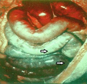 Fig. 25.3, Ischemic Bowel.