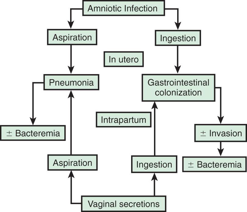 Fig. 129.3, Pathways of ascending or intrapartum infection.