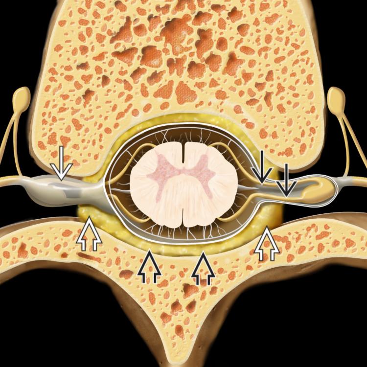 Normal Anatomy