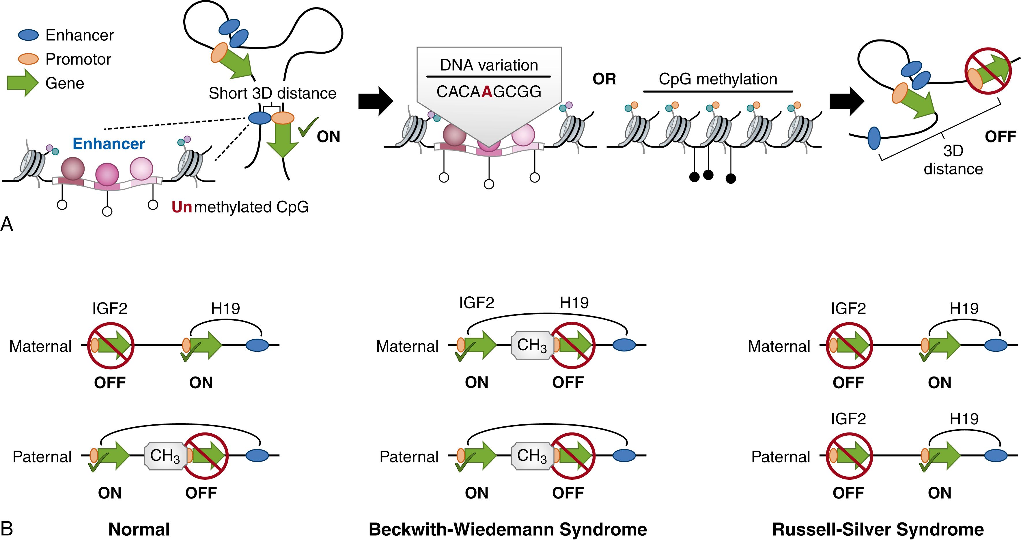 Fig. 2.3, Spatial associations, differential methylation, and imprinting. (A) DNA variation or epigenetic marks can alter the spatial conformation of DNA so that elements normally regulated together are quite far apart. (B) On chromosome 11 (11p15) is a developmentally critical imprinting control region (IGF2 locus). In normal cells, the imprinted IGF2 locus is regulated differently in the maternally and paternally derived chromatin. Hypermethylation of the H19 promotor and loss of imprinting of IGF2 are detectable in 2% to 7% of BWS patients (resulting in over-expression of IGF2). Hypomethylation of the same promoter in RSS patients prevents IGF2 promoter interactions (resulting in under-expression of IGF2).