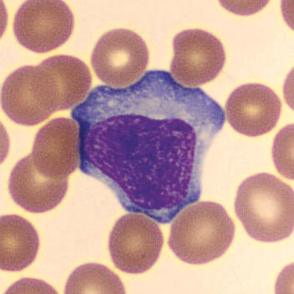 FIGURE 348-1, An atypical lymphocyte.