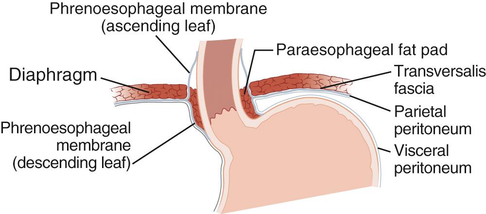 FIGURE 34-3, Attachments of the phrenoesophageal membrane.