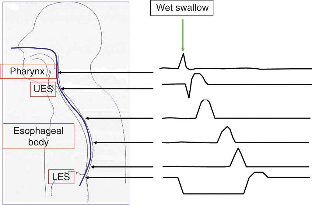 FIGURE 2.2, Physiology of swallowing. UES, Upper esophageal sphincter.