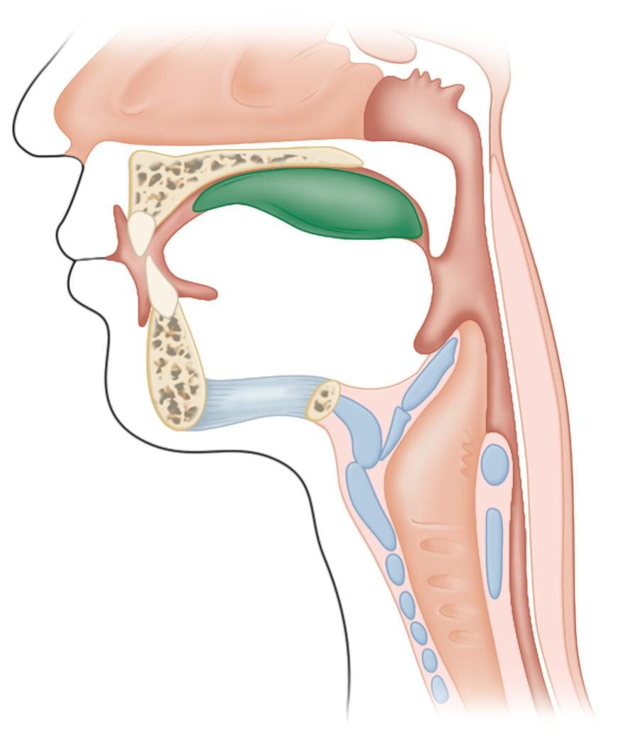 FIGURE 1.1, The swallowing process: The tongue has formed a bolus between the ventral part of the tongue and its posterior part against the soft palate.