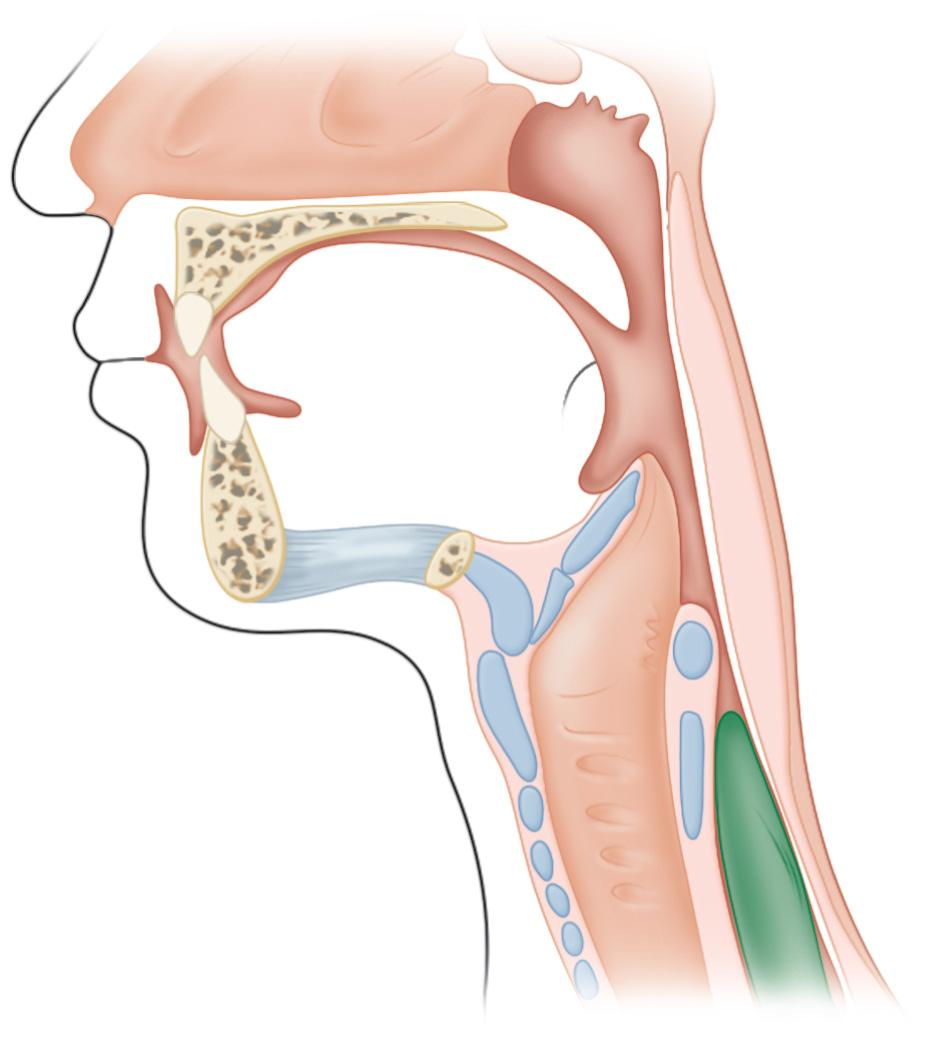 FIGURE 1.3, The swallowing process: The upper esophageal sphincter is fully relaxed for a short time in which the bolus passes into the proximal esophagus, where it is pushed farther by gravity and esophageal peristalsis. The larynx and epiglottis then resume their resting positions.