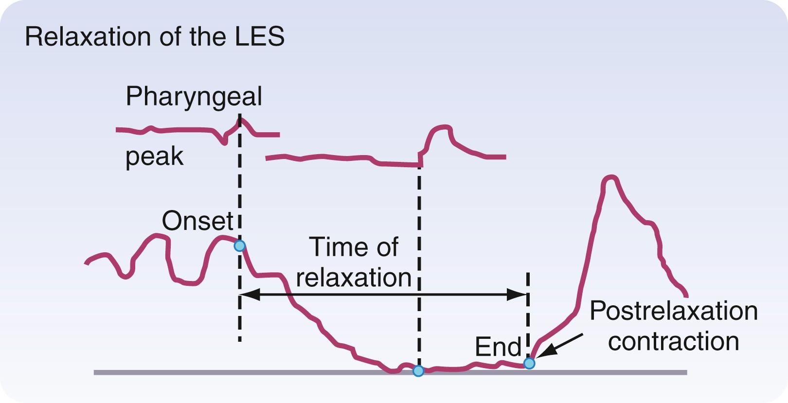 Fig. 42.16, Relaxation of the lower esophageal sphincter (LES).