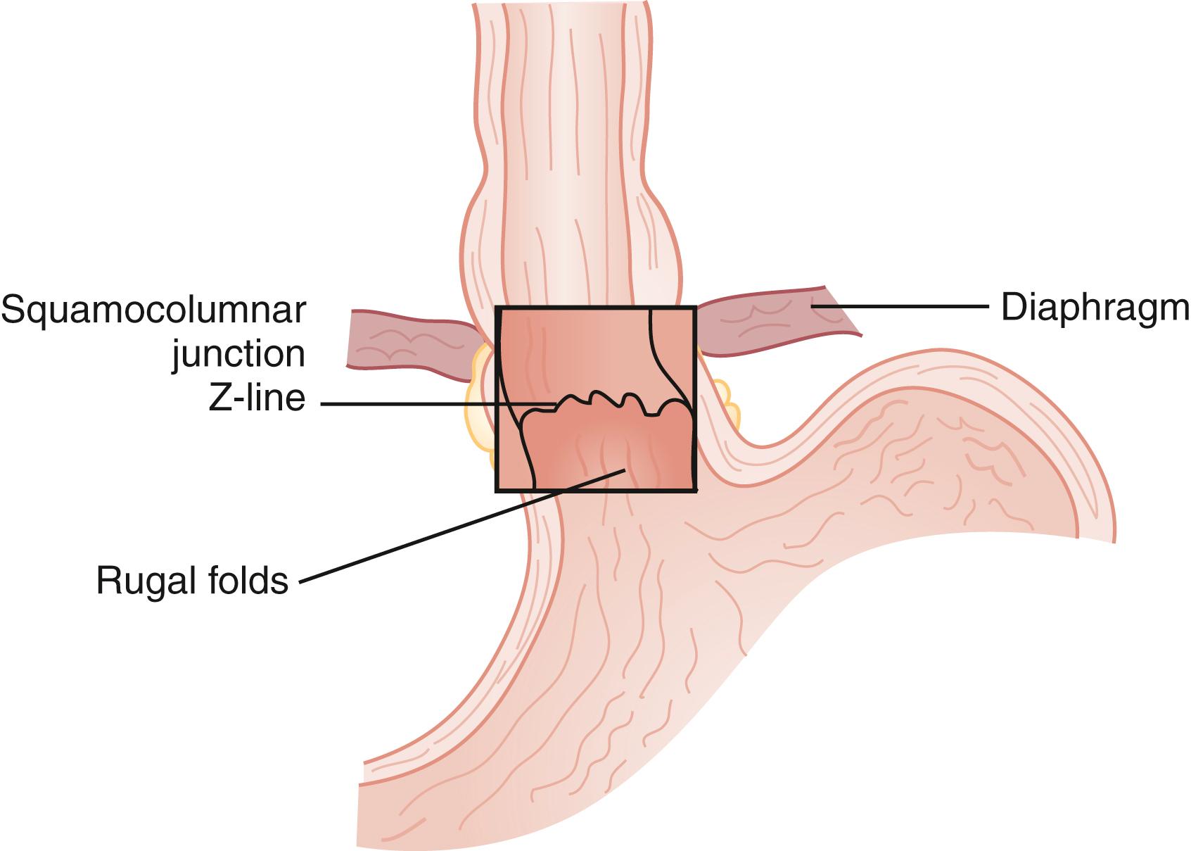 Fig. 42.2, Z-line.