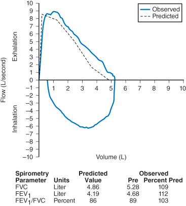 FIGURE 13.2, Normal pulmonary function test. The normal flow–volume curve obtained during forced expiration rapidly ascends to the peak expiratory flow (highest point on curve), then descends with decreasing volume, following a reproducible shape that is independent of effort. In this normal flow–volume curve, the forced vital capacity (FVC), forced expiratory volume in 1 second (FEV 1 ), and FEV 1 /FVC ratio are all within the normal range for this child's age, height, gender, and race. The shapes of both the inspiratory and expiratory limbs are normal as well. Pre, prebronchodilator; Pred, predicted value.