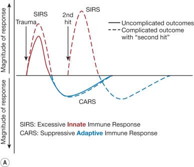 Fig. 30.3, Comparison of the genomic response of leukocytes to burn in complicated and uncomplicated outcomes.