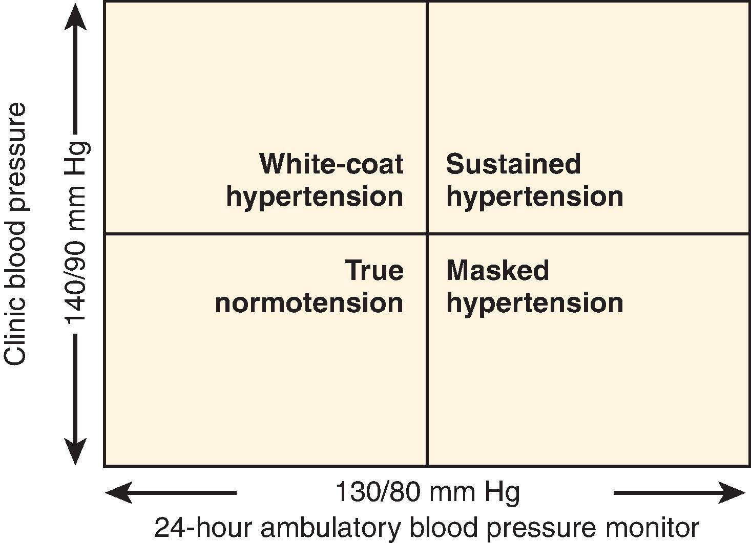 • Fig. 64.2, Use of ambulatory blood pressure monitoring in diagnosing hypertension. This grid helps to integrate ambulatory blood pressure (BP) monitor data with office BP results. Sustained hypertension is diagnosed if office BP is ≥140/90 mm Hg and 24-hour average of ambulatory BP is ≥130/80 mm Hg. White-coat hypertension is diagnosed when office BP is ≥140/90 mm Hg but 24-hour average of ambulatory BP is <130/80 mm Hg. Masked hypertension is diagnosed when office BP is <140/90 mm Hg but 24-hour average of ambulatory BP is ≥130/80 mm Hg.