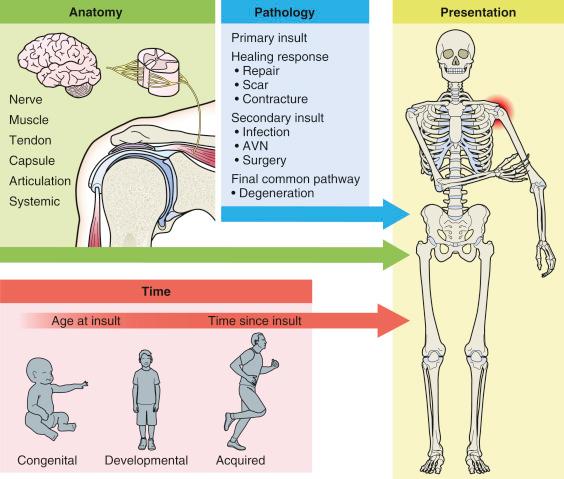 FIG. 34.1, Three factors make up the assessment and classification of the stiff shoulder: anatomy, pathology, and time. AVN, Avascular necrosis.