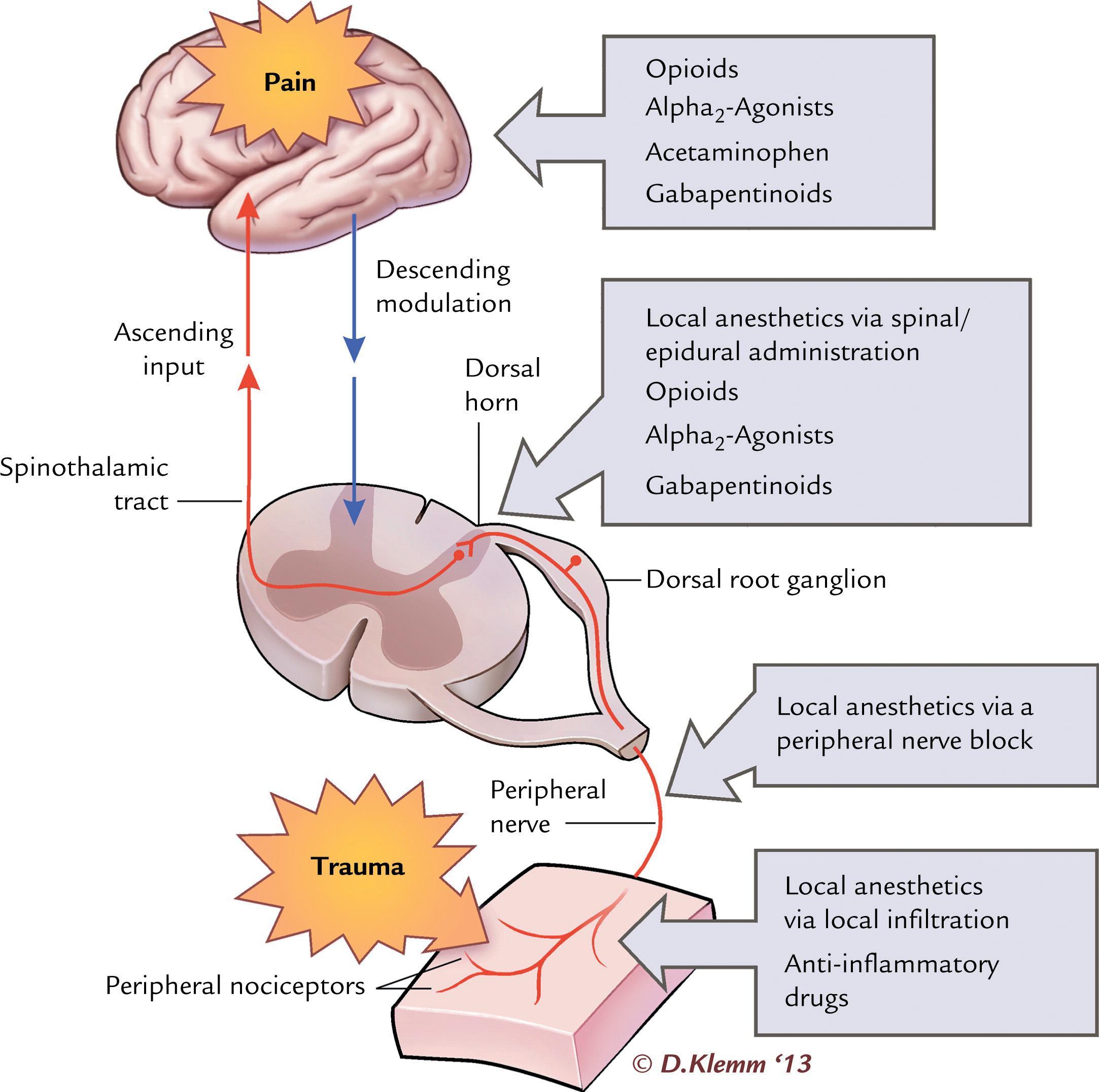 Figure 28.2, The pain pathway and locations of action for various analgesics.