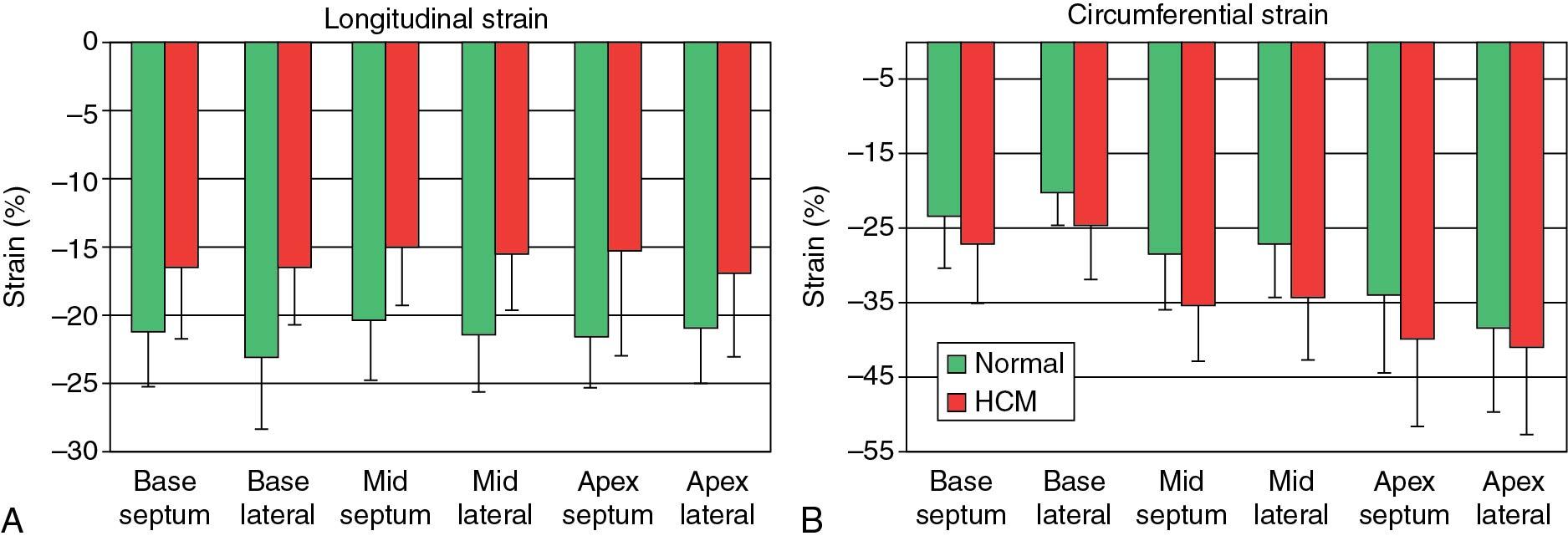 Fig. 4.1, Longitudinal and circumferential strain in hypertrophic cardiomyopathy (HCM). There is a uniform reduction in longitudinal strain in all regions ( A ). Patients with HCM consistently show lower strain than controls ( P <.05). ( B ) In contrast, there is less circumferential deformation in the base than the apex, and strain is significantly higher in HCM for all segments except lateral apex ( P <.05).